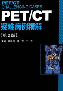 奥特曼之传奇欧布