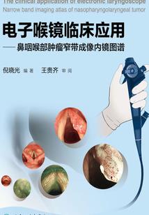月斜窗纸