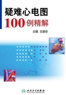 王冠和城堡